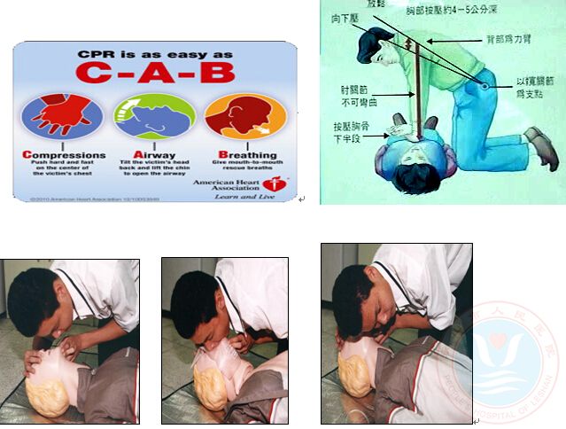 徒手心肺复苏术(cpr)