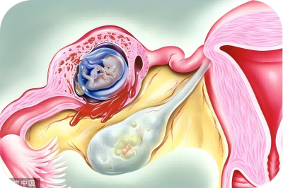 图片3(1).png 图片3(1).png